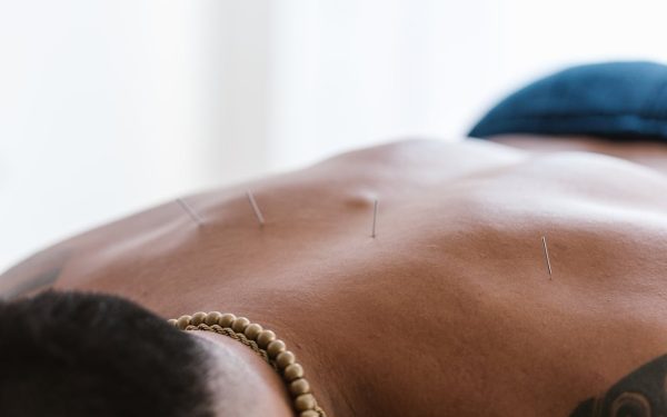 Acupuntura Estética: Rejuvenescimento Natural da Pele